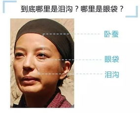 一、泪痕的成因