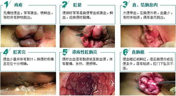 边老便便：症状解析与应对方案