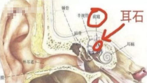 当1卢比硬币滚入下水道，整个孟买为之震动