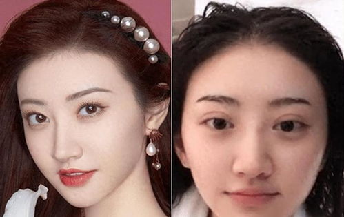 当命运之砂刺痛眼睑，这对母子选择用爱研磨成珍珠