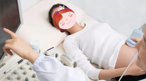 哪个app可看免费足球比赛,哪个app可看免费足球比赛直播