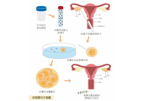 湖南试管婴儿技术全解析-应用流程与注意事项