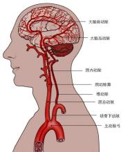 一、血管神经性头痛的症状表现