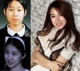 一、刘仁娜整容的传闻与真相